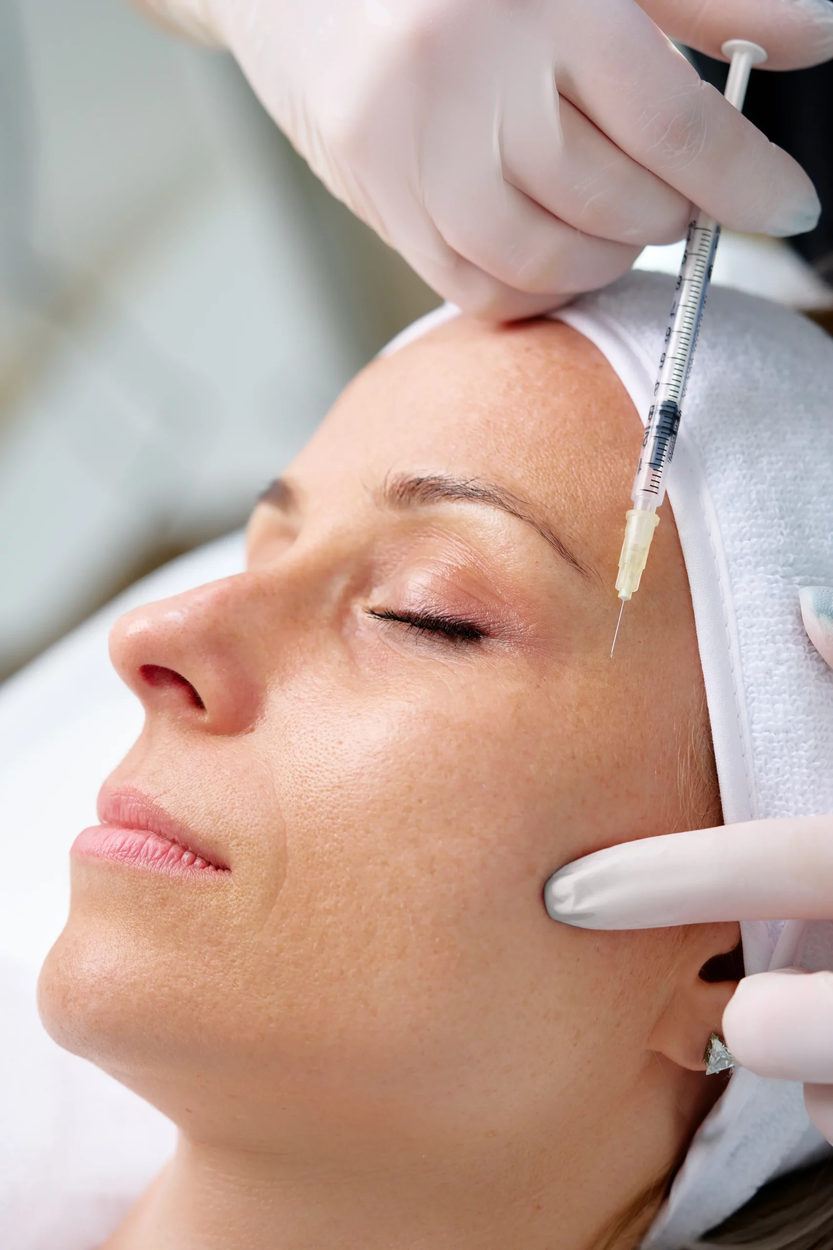 Injections-de-Botox-lifting-medical-du-regard-La-Meuse